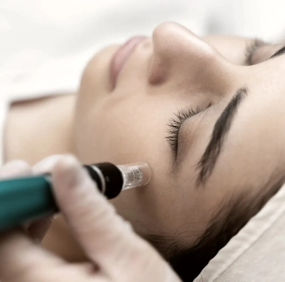 A microneedling pen being drawn across a cheek, the eyes closed